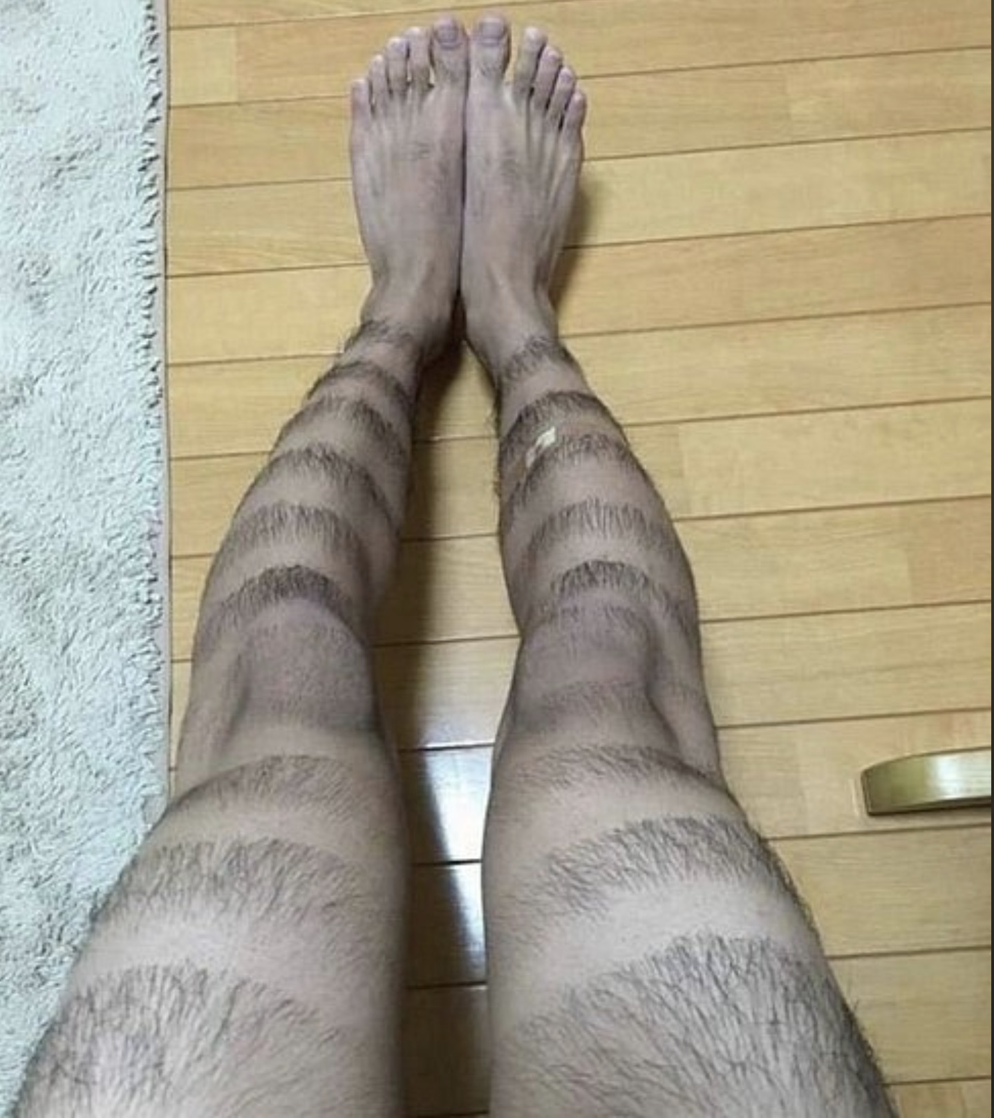 funny leg